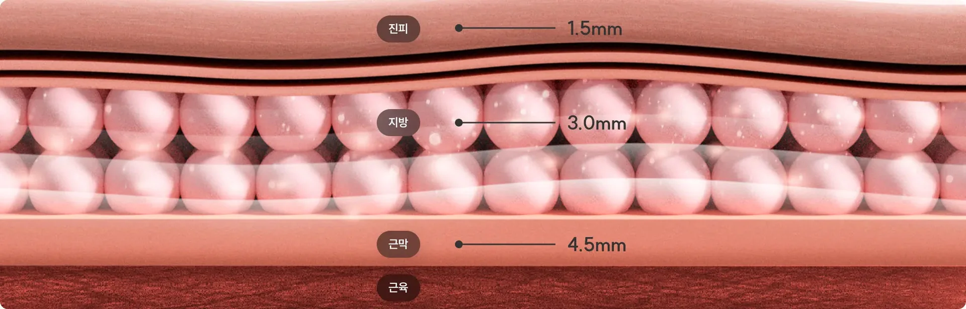 Ulthera skin viewing