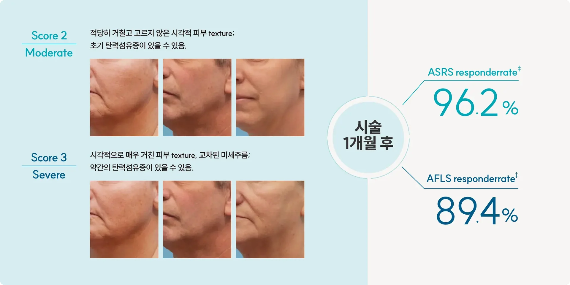 Skinvive for wrinkles