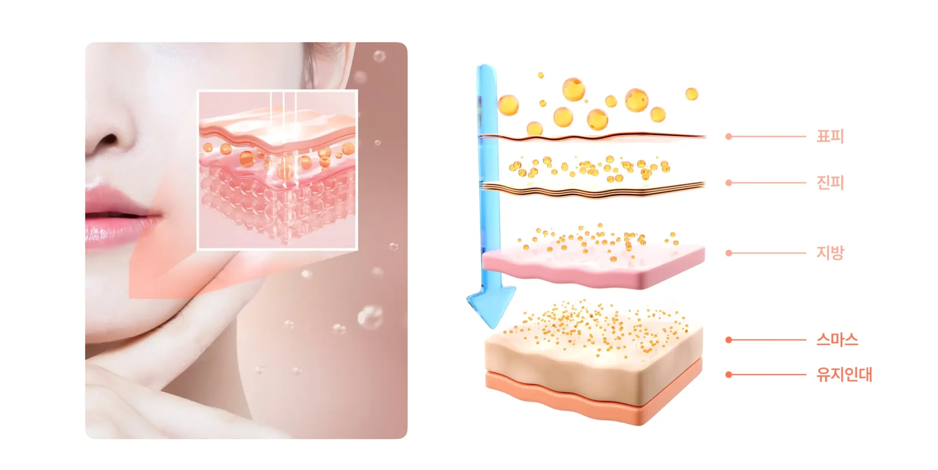 Titanum-lifting skin layer