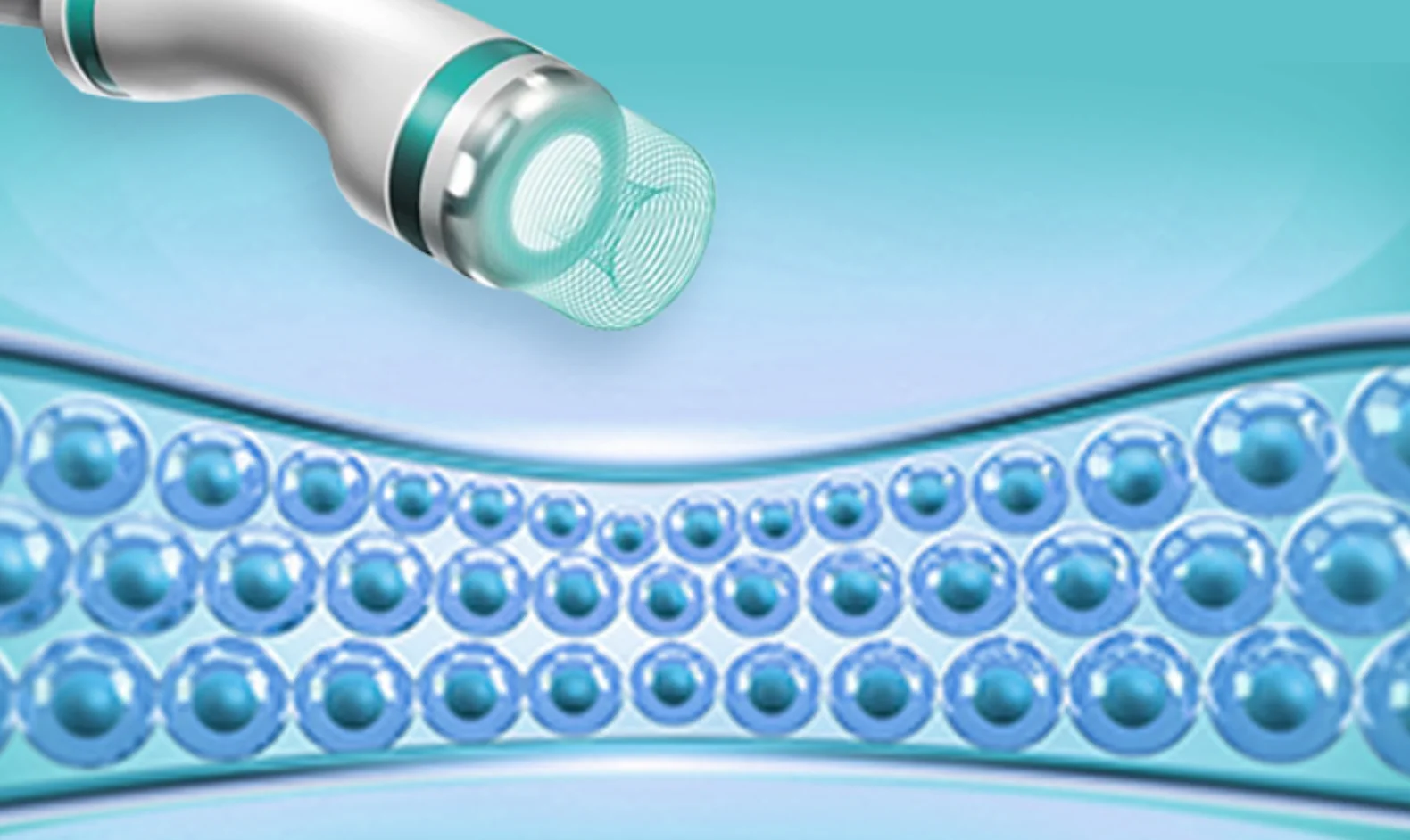 3mm handpiece of Onda lifting