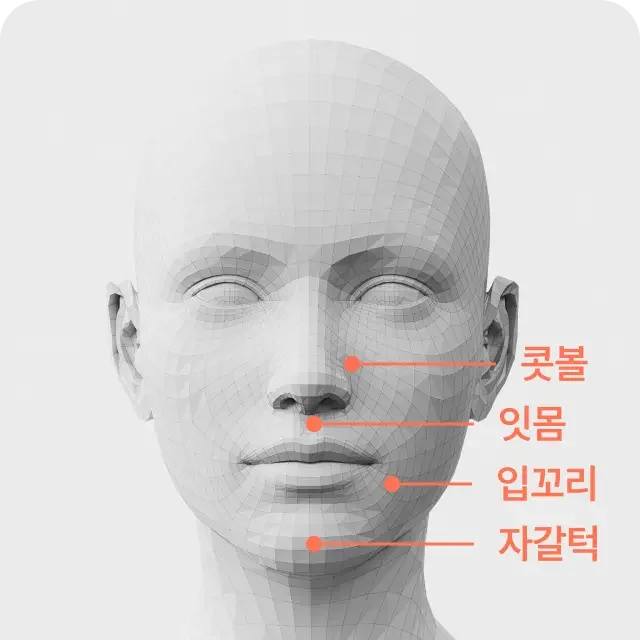 Anti-Wrinkle Injections treatment area 3