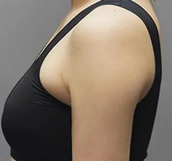 Body Injection before result