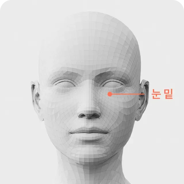 Anti-Wrinkle Injections treatment area 2
