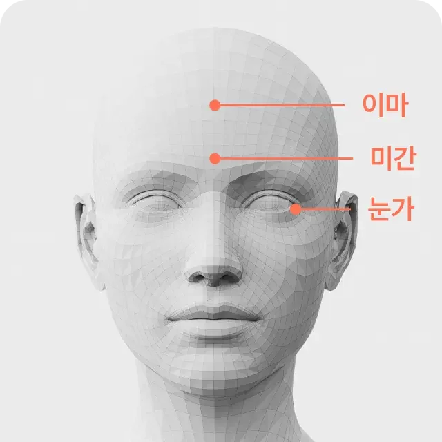 Anti-Wrinkle Injections treatment area 1