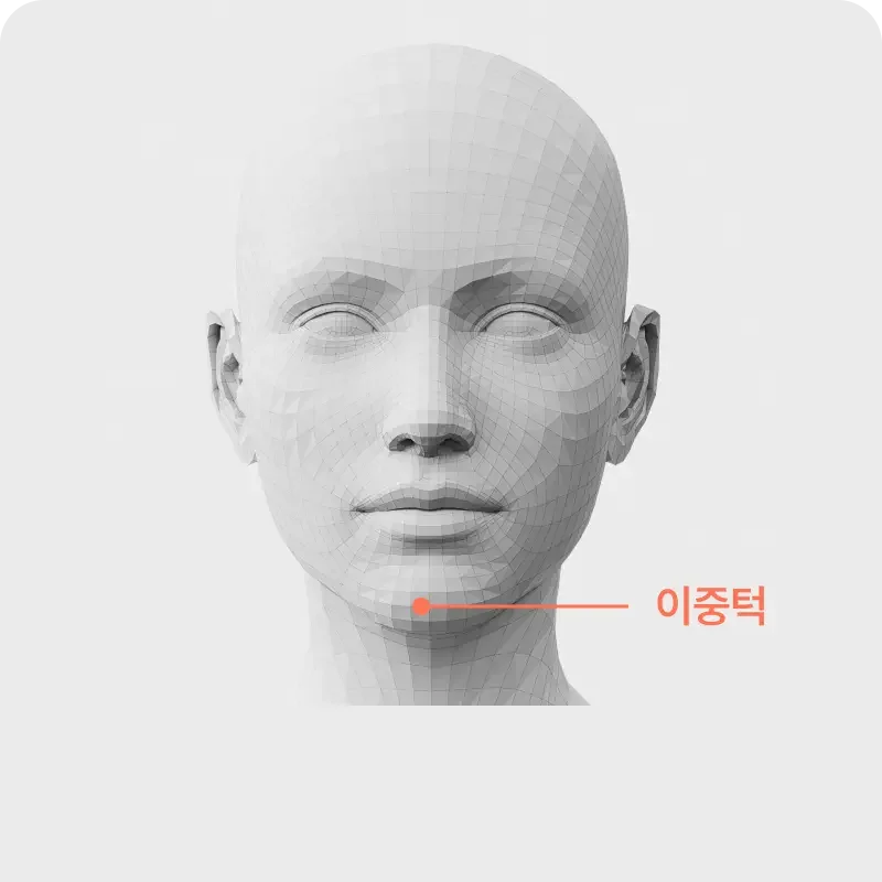 Ulthera skin parts