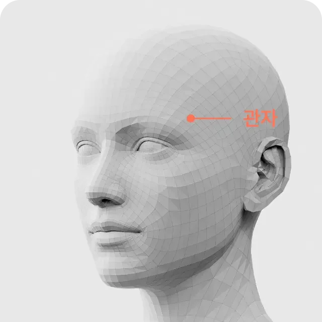 Volume filler upper face 2