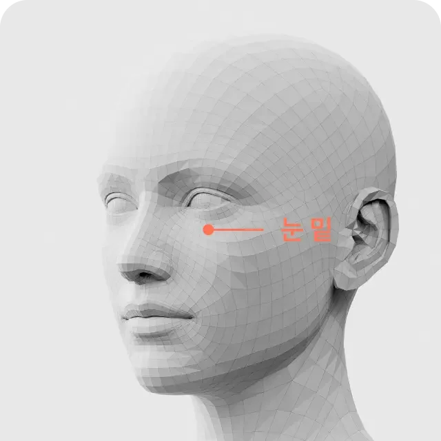 Volume filler mid face 1